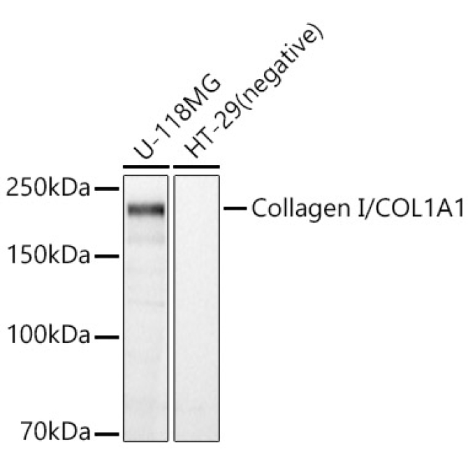 Collagen I/COL1A1 Rabbit Polyclonal Antibody