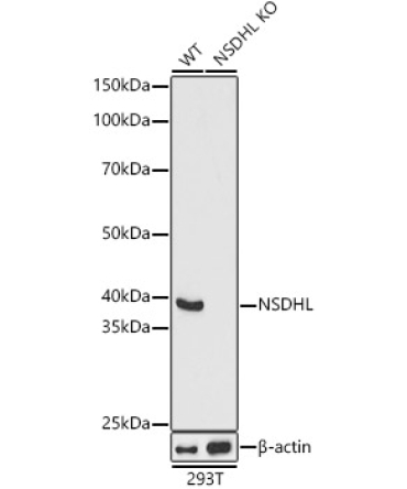 NSDHL Rabbit Polyclonal Antibody [KO Validated]