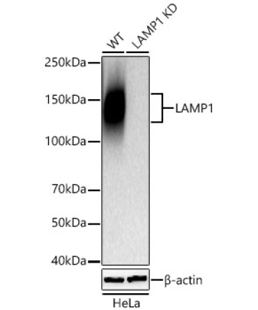 LAMP1 Rabbit Polyclonal Antibody [KD Validated]