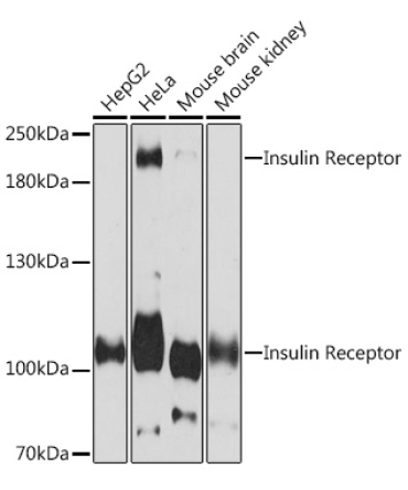 Insulin Receptor Rabbit Polyclonal Antibody