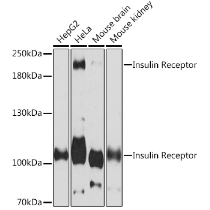 Insulin Receptor Rabbit Polyclonal Antibody