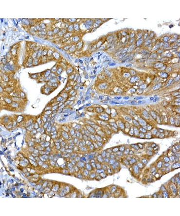 IRS1 Rabbit Polyclonal Antibody