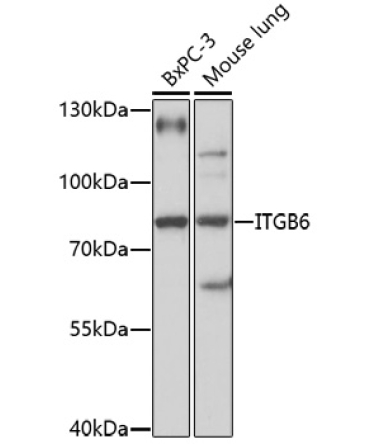 ITGB6 Rabbit Polyclonal Antibody