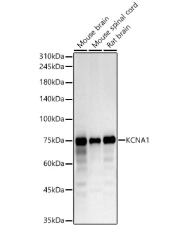 KCNA1 Rabbit Polyclonal Antibody