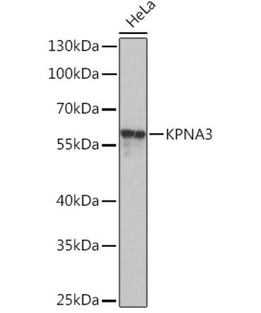 KPNA3 Rabbit Polyclonal Antibody