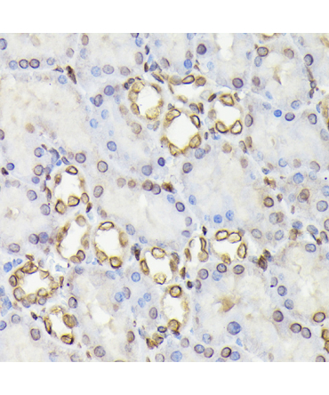 Lamin B1 Rabbit Polyclonal Antibody