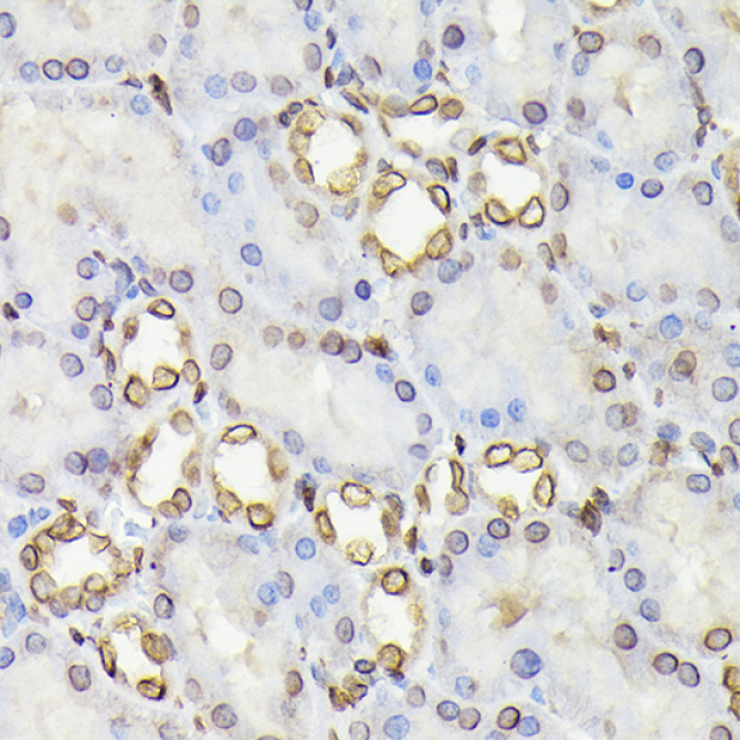 Lamin B1 Rabbit Polyclonal Antibody