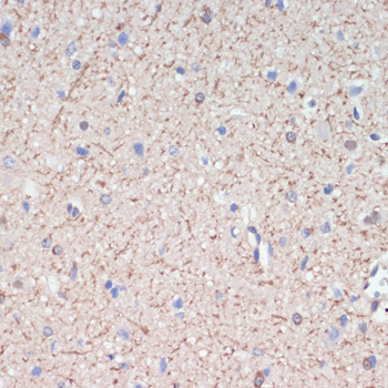 MAG Rabbit Polyclonal Antibody