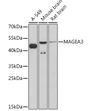 MAGEA3 Rabbit Polyclonal Antibody