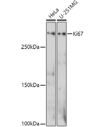 Ki67 Rabbit Polyclonal Antibody