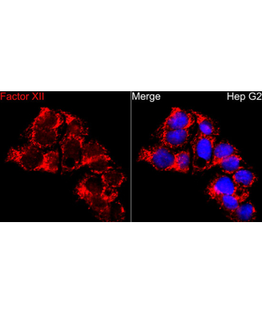 F12 Rabbit Polyclonal Antibody
