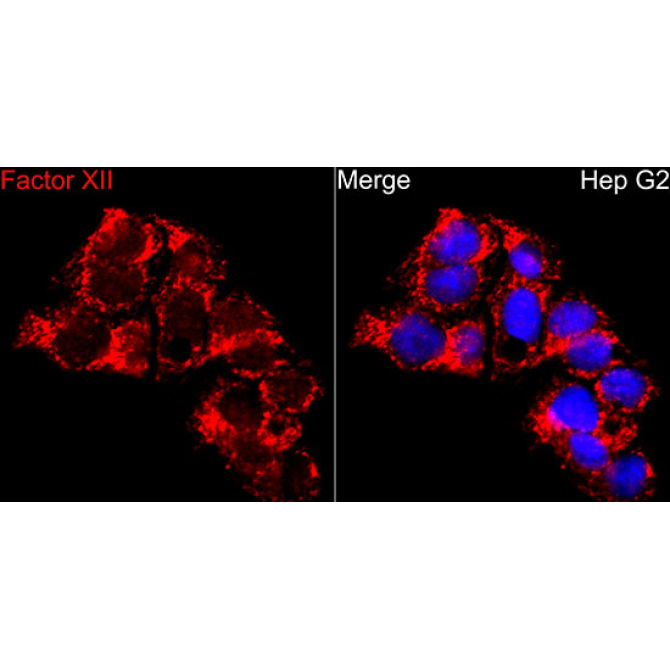 F12 Rabbit Polyclonal Antibody