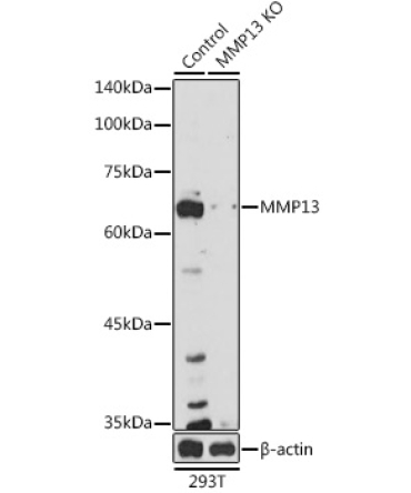MMP13 Rabbit Polyclonal Antibody [KO Validated]