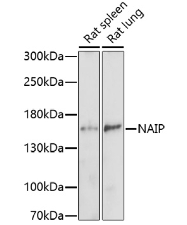 NAIP Rabbit Polyclonal Antibody