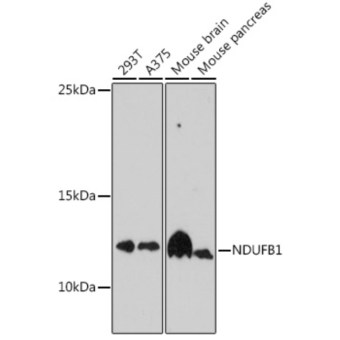 NDUFB1 Rabbit Polyclonal Antibody