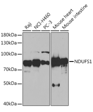 NDUFS1 Rabbit Polyclonal Antibody
