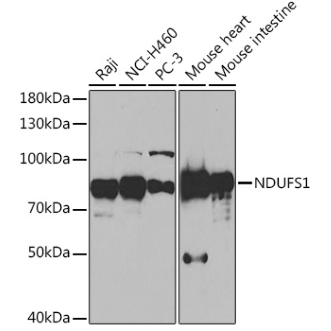 NDUFS1 Rabbit Polyclonal Antibody