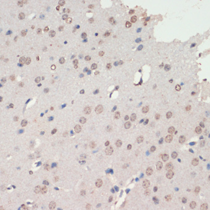 NEUROD1 Rabbit Polyclonal Antibody