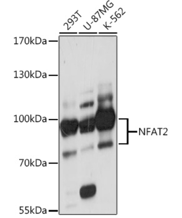 NFAT2 Rabbit Polyclonal Antibody