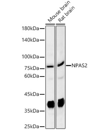 NPAS2 Rabbit Polyclonal Antibody