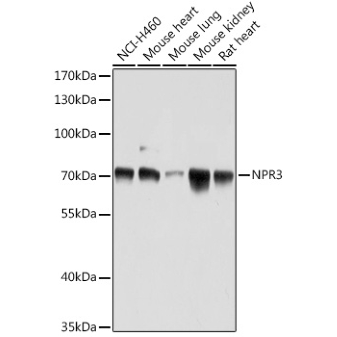 NPR3 Rabbit Polyclonal Antibody