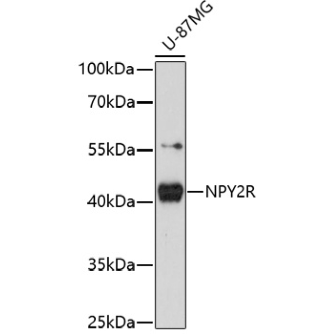 NPY2R Rabbit Polyclonal Antibody