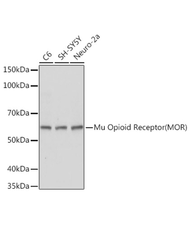 Mu Opioid Receptor(MOR) Rabbit Polyclonal Antibody