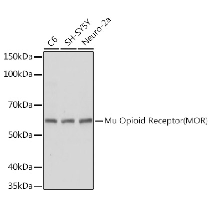 Mu Opioid Receptor(MOR) Rabbit Polyclonal Antibody