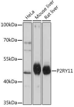 P2RY11 Rabbit Polyclonal Antibody