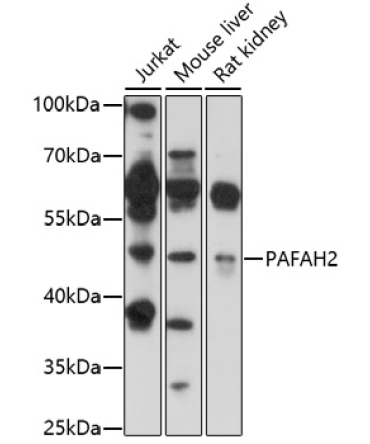 PAFAH2 Rabbit Polyclonal Antibody