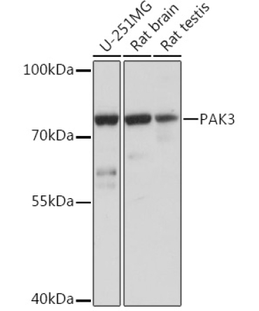 PAK3 Rabbit Polyclonal Antibody