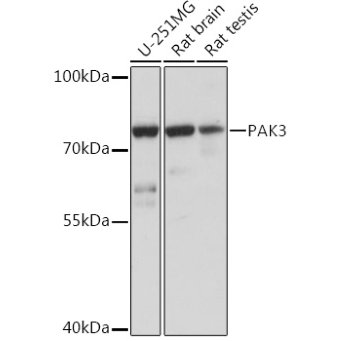 PAK3 Rabbit Polyclonal Antibody