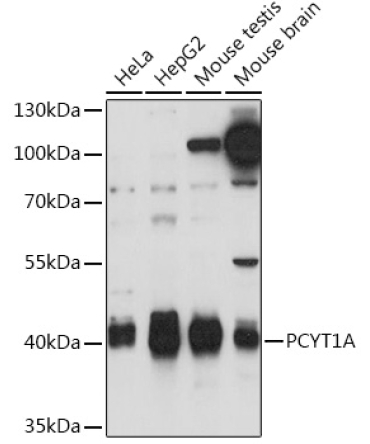 PCYT1A Rabbit Polyclonal Antibody
