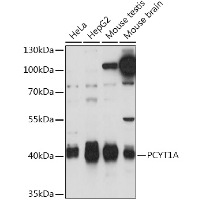 PCYT1A Rabbit Polyclonal Antibody