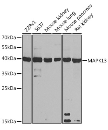 MAPK13 Rabbit Polyclonal Antibody