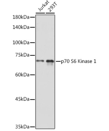 p70 S6 Kinase 1 Rabbit Polyclonal Antibody