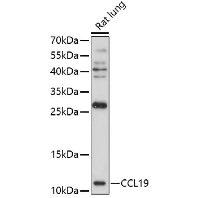 CCL19 Rabbit Polyclonal Antibody