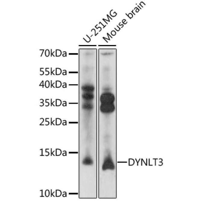DYNLT3 Rabbit Polyclonal Antibody