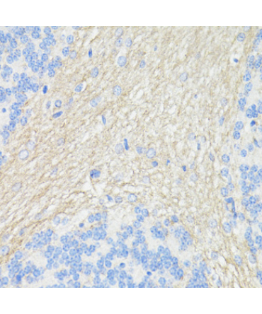 CD90/Thy1 Rabbit Polyclonal Antibody