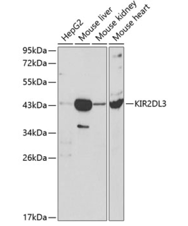 KIR2DL3 Rabbit Polyclonal Antibody