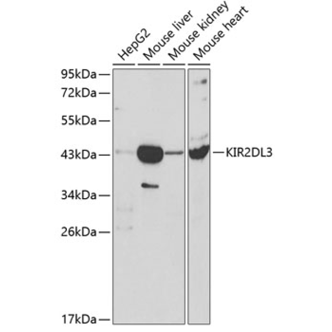 KIR2DL3 Rabbit Polyclonal Antibody