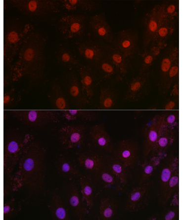 HIF1Beta/ARNT Rabbit Polyclonal Antibody