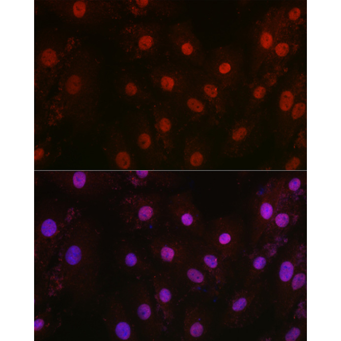 HIF1Beta/ARNT Rabbit Polyclonal Antibody
