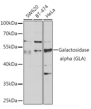 Galactosidase alpha (GLA) Rabbit Polyclonal Antibody