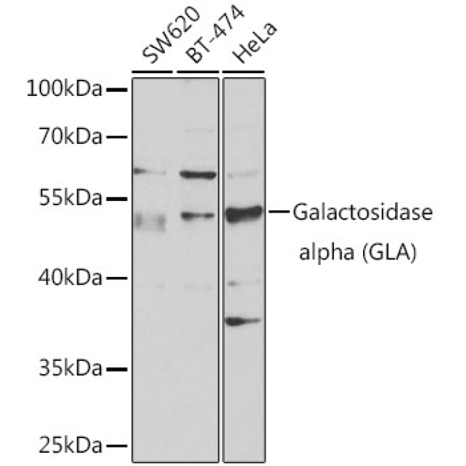 Galactosidase alpha (GLA) Rabbit Polyclonal Antibody