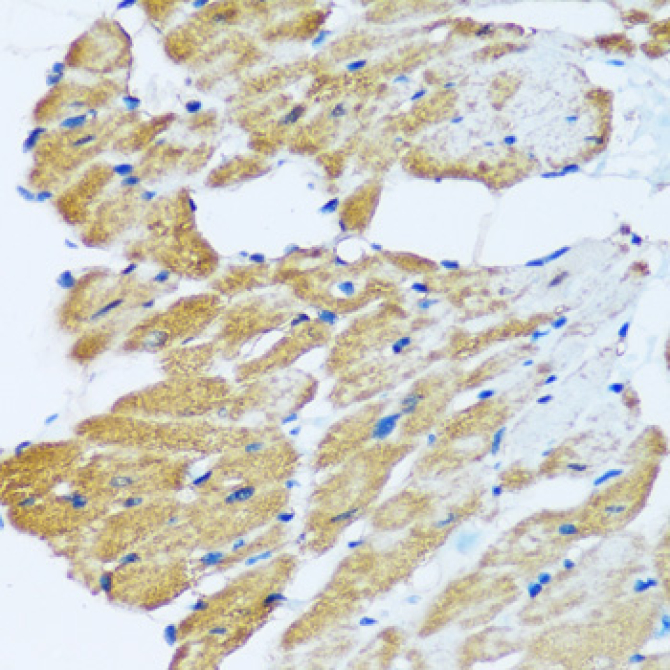 ARHGEF5 Rabbit Polyclonal Antibody