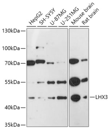 LHX3 Rabbit Polyclonal Antibody