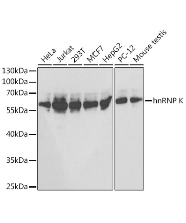 hnRNP K Rabbit Polyclonal Antibody