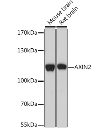 AXIN2 Rabbit Polyclonal Antibody