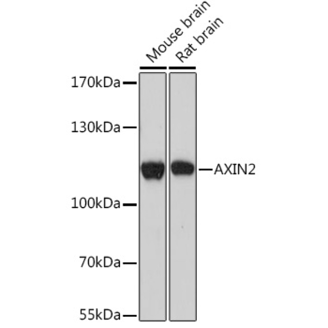 AXIN2 Rabbit Polyclonal Antibody